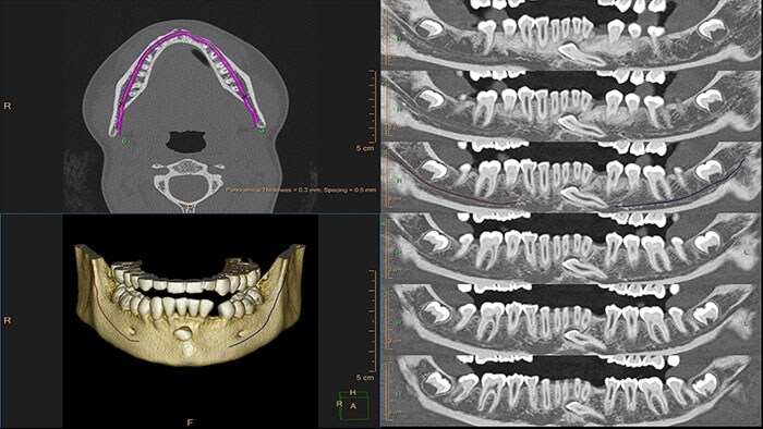 dental planning thumbnail