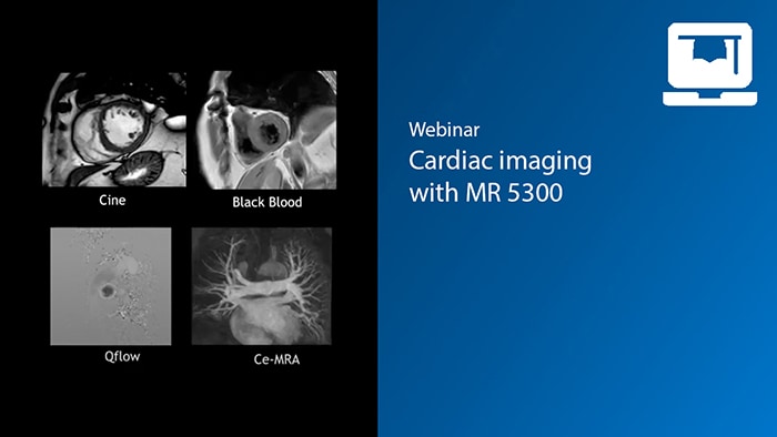 Cardiac imaging