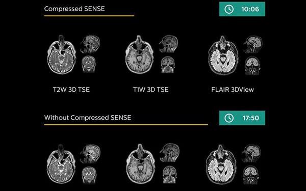 compressed_sense