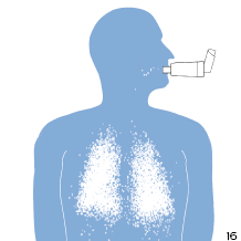 Inhalator s komorom