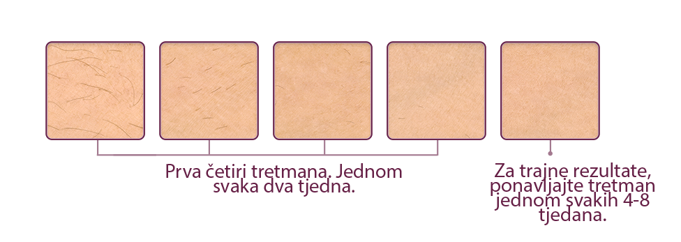 Philips Lumea Ipl Uređaj Philips